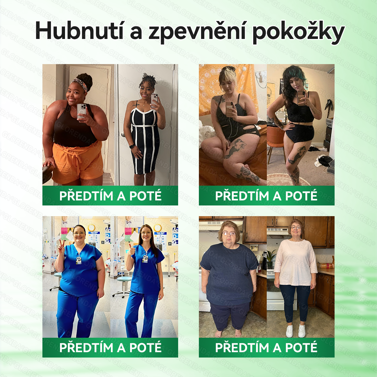 Oficiální obchod | 🌿𝑮𝑳𝑶𝐑𝐄𝐍𝐃𝘼® Moringa · Berberin × NAD+ 10v1 Pokročilá nano náplast s mikrojehlami (pouze jednou denně, viditelné výsledky již za 7 dní) 🌿Pro osoby s obezitou, ochablou pokožkou, cukrovkou a problémy s klouby