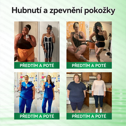 Oficiální obchod | 🌿𝑮𝑳𝑶𝐑𝐄𝐍𝐃𝘼® Moringa · Berberin × NAD+ 10v1 Pokročilá nano náplast s mikrojehlami (pouze jednou denně, viditelné výsledky již za 7 dní) 🌿Pro osoby s obezitou, ochablou pokožkou, cukrovkou a problémy s klouby