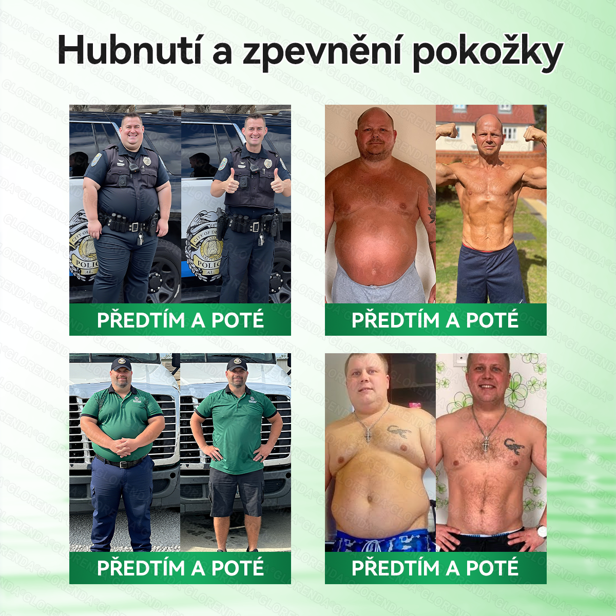 Oficiální obchod | 🌿𝑮𝑳𝑶𝐑𝐄𝐍𝐃𝘼® Moringa · Berberin × NAD+ 10v1 Pokročilá nano náplast s mikrojehlami (pouze jednou denně, viditelné výsledky již za 7 dní) 🌿Pro osoby s obezitou, ochablou pokožkou, cukrovkou a problémy s klouby