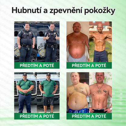 Oficiální obchod | 🌿𝑮𝑳𝑶𝐑𝐄𝐍𝐃𝘼® Moringa · Berberin × NAD+ 10v1 Pokročilá nano náplast s mikrojehlami (pouze jednou denně, viditelné výsledky již za 7 dní) 🌿Pro osoby s obezitou, ochablou pokožkou, cukrovkou a problémy s klouby